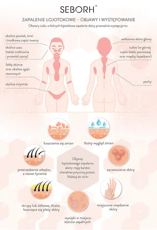 Kosmetyki na ŁZS od Verdelove efektywnie niwelują wszystkie typowe objawy tej dermatozy. 